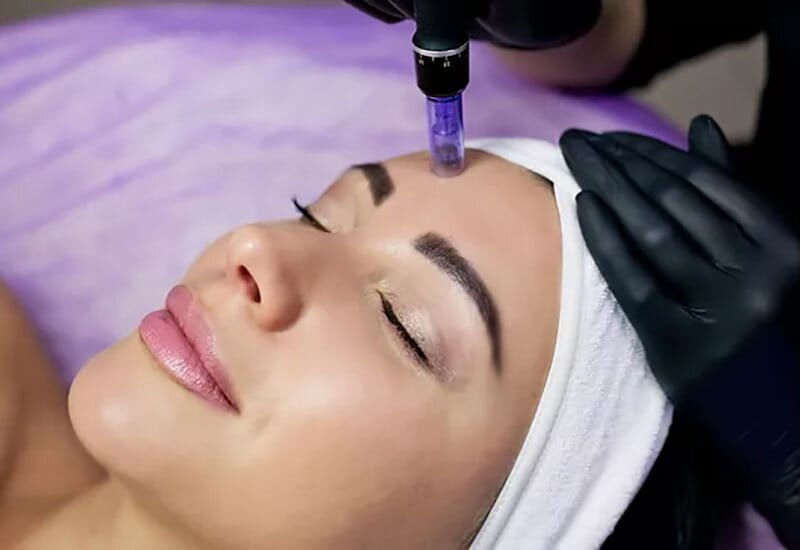 Micro-needling pen treatment on facial skin