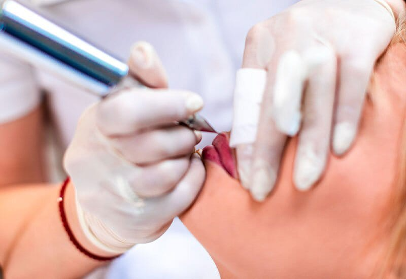 Lip blush pigmentation procedure